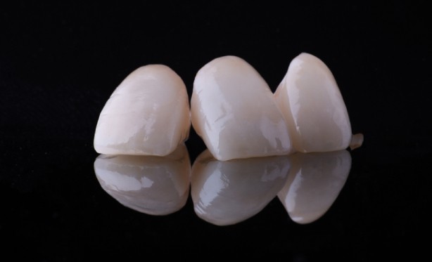 Dental crowns and caps Southend-on-Sea, Essex